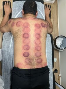 教徒需要進行每半年一次放血