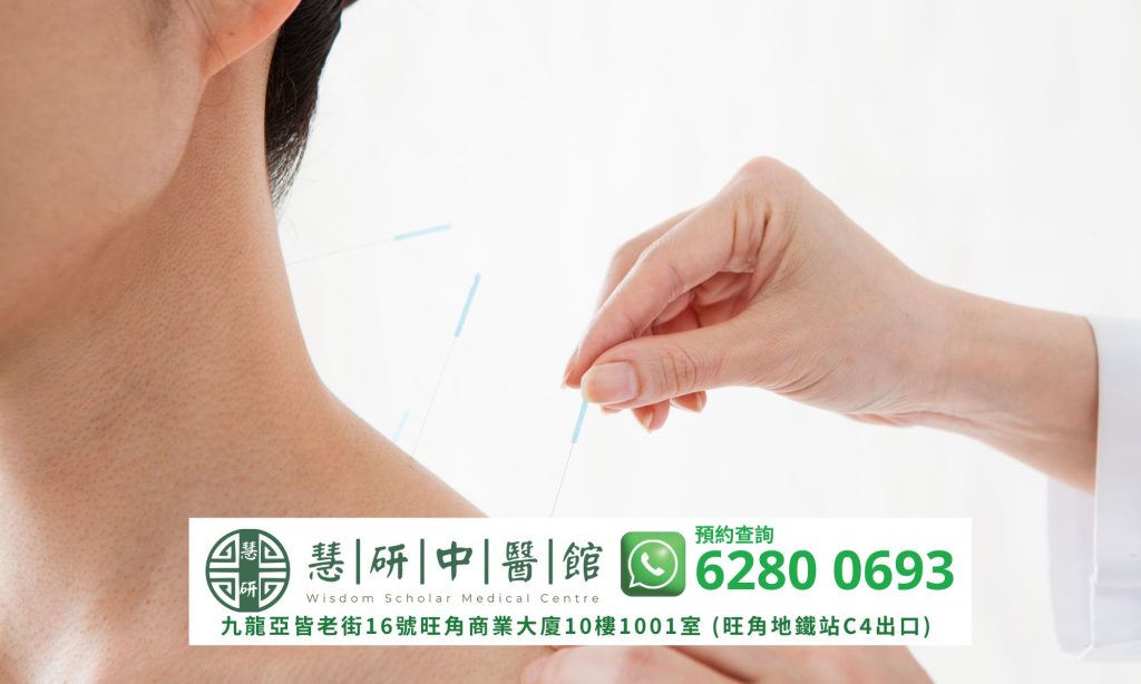 中醫如何治療五十肩/肩周炎