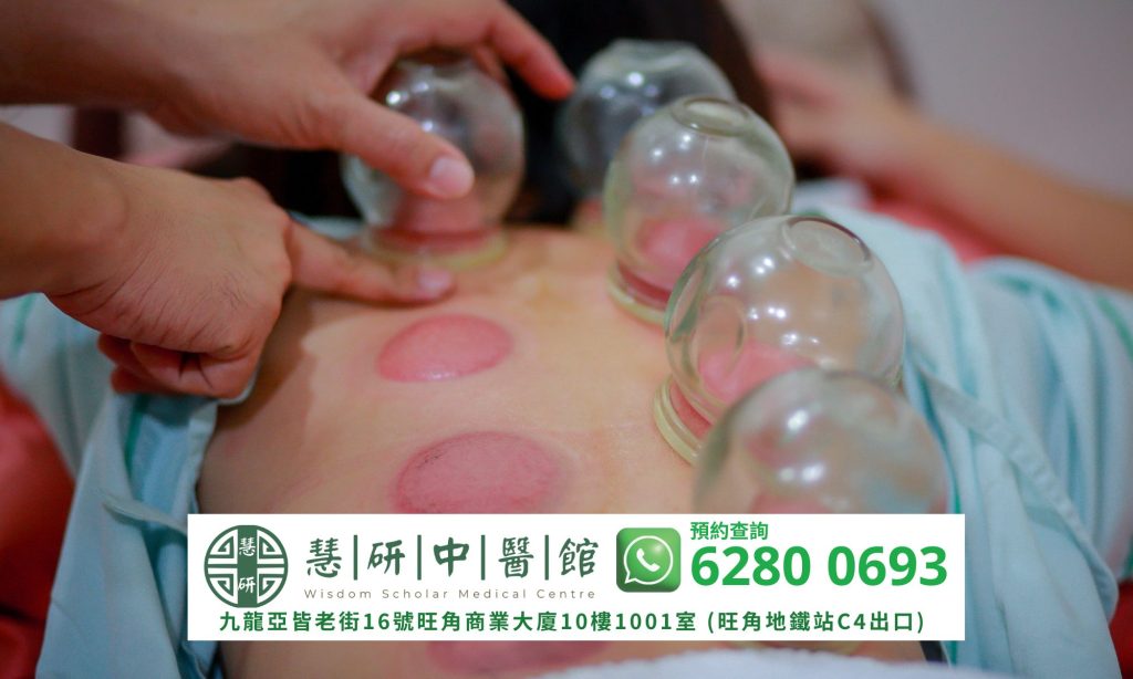 拔罐療法