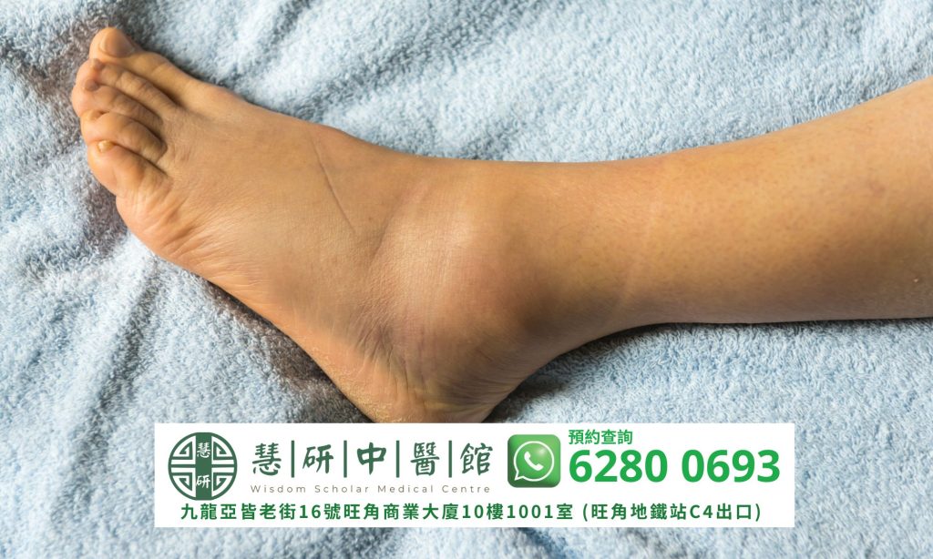 慧研中醫草藥專門治療足踝扭傷